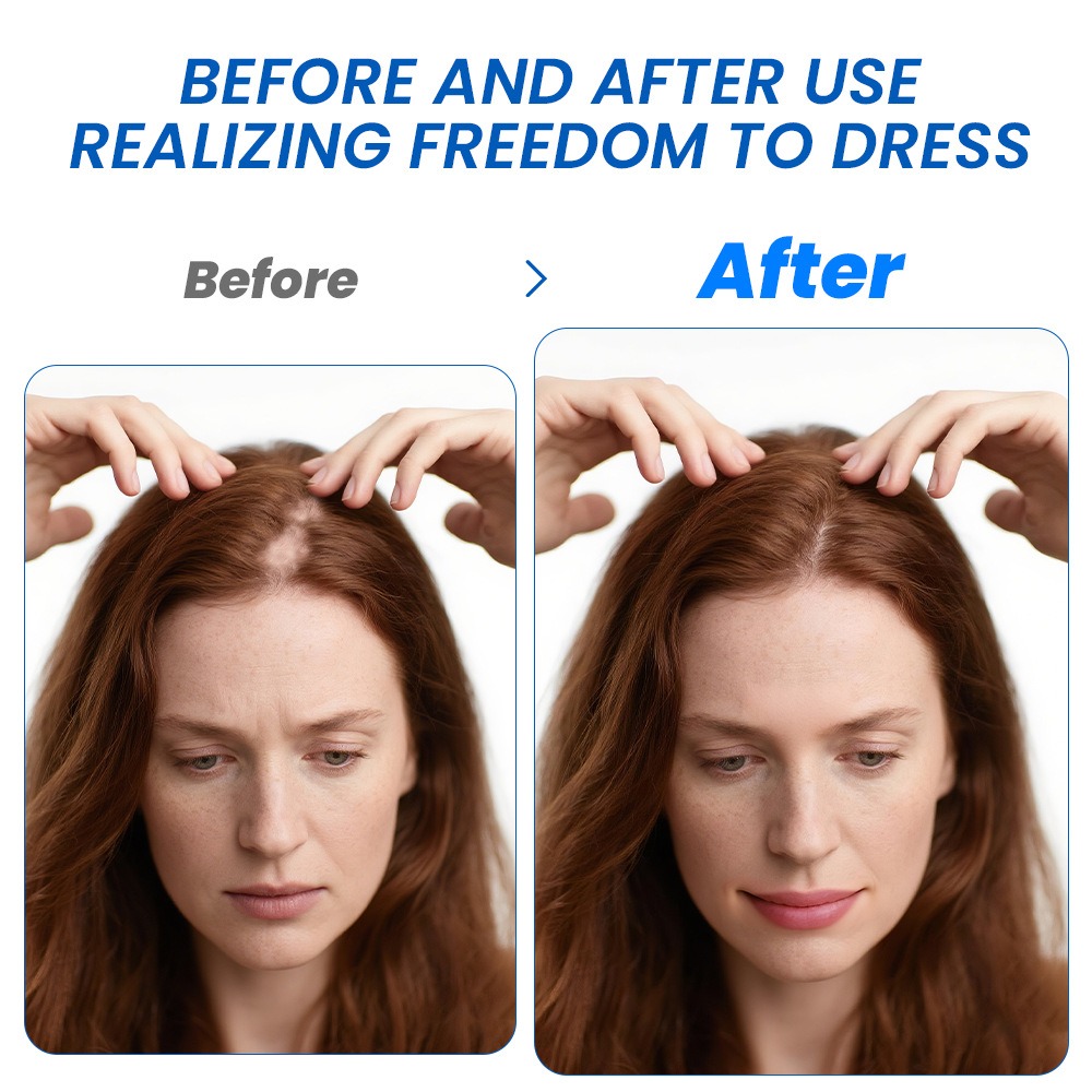 Alopecia Hair Growth Spray Sop - огляд і ціна Hair Care Spray