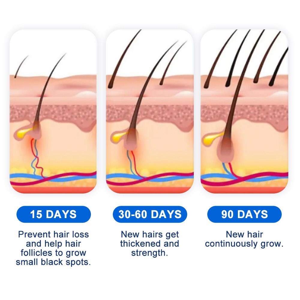 Alopecia Hair Growth Spray Sop - огляд і ціна Hair Care Spray