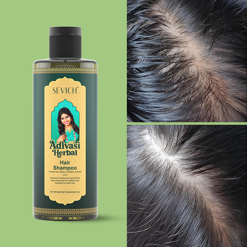 SEVICH Herbal Hair Growth Oil  - огляд і ціна Hair Care India