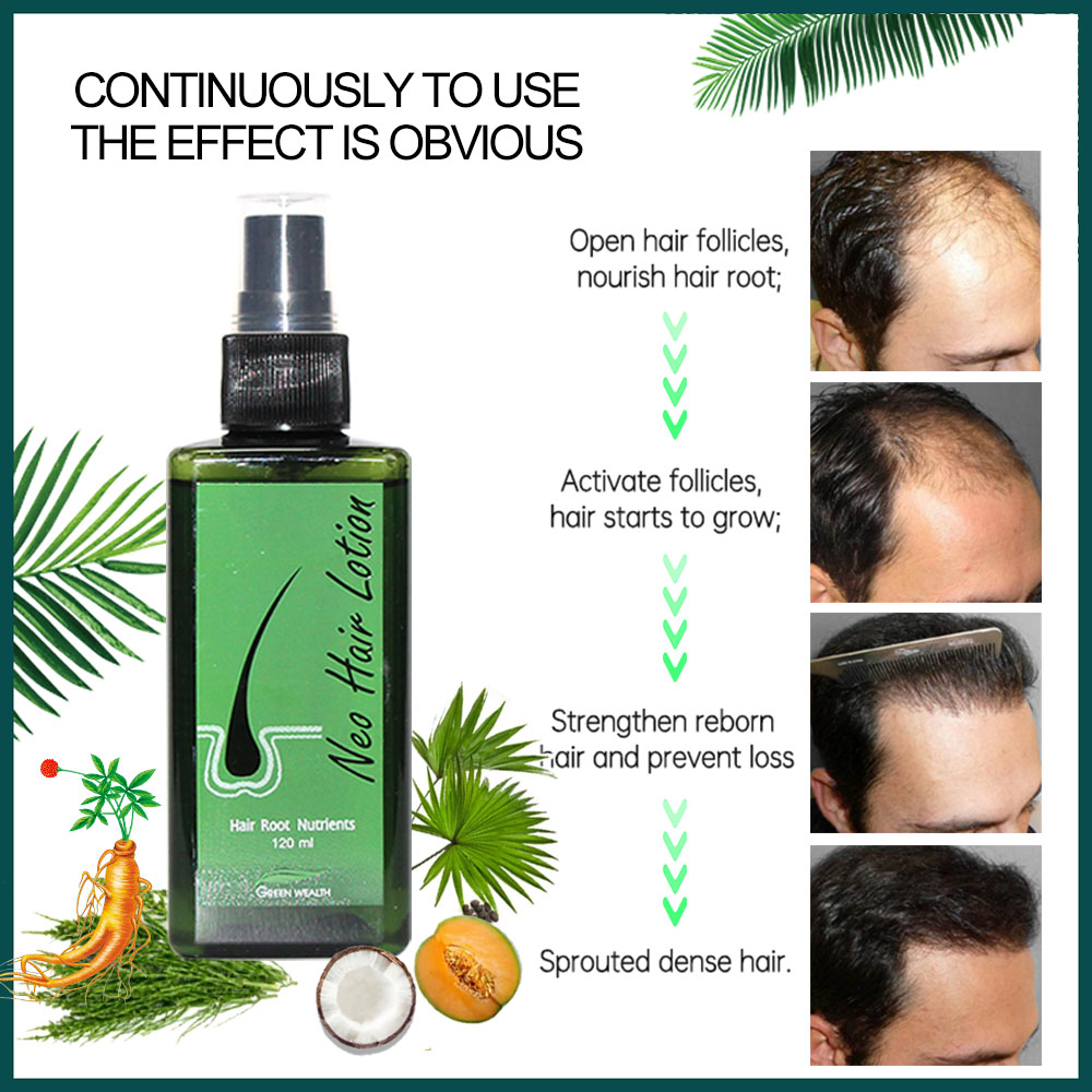 Original Neo Hair Lotion 120ml - огляд і ціна Hair Care Thailand