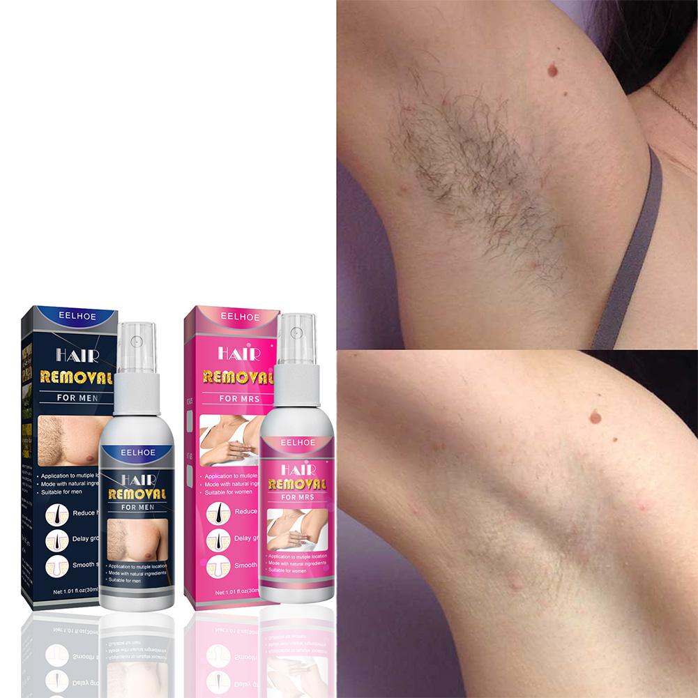 1/2PCS Super Natural Painless  - огляд і ціна Hair Care Spray