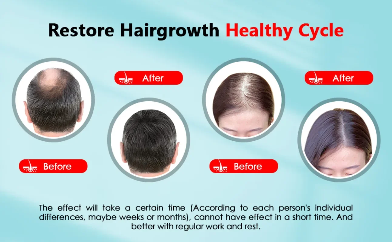 Hair Growth Cap Rechargeable 2 - огляд і ціна Hair Care Vegan